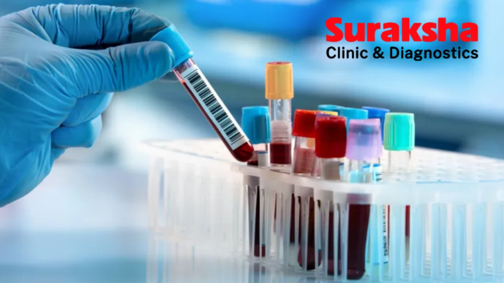 Suraksha Diagnostic IPO